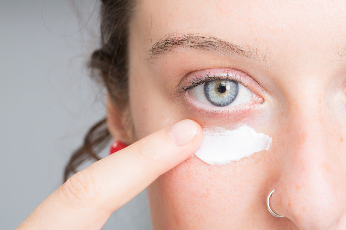 Treat Dark Under-Eye Circles and Puffy Eyes Naturally